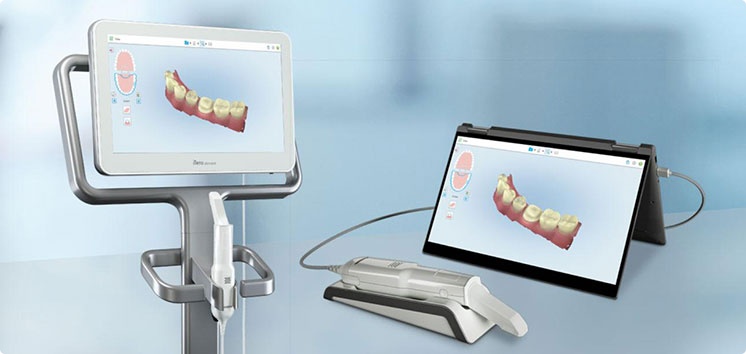 Impronte dentali con sistema digitale